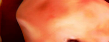 8. teden nosečnosti