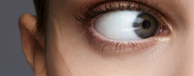 Lanolin alkohol (Lanolin Alcohol)